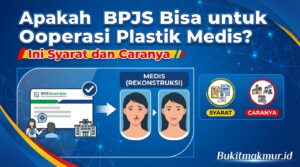 Apakah BPJS Bisa untuk Operasi Plastik Medis? Ini Syarat dan Caranya