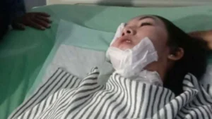 Kasus Penyiraman Air Keras di Bekasi Kembali Teror Warga