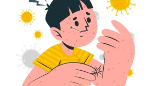 Vaksinasi Campak Dewasa: Solusi Penting Melindungi Kesehatan