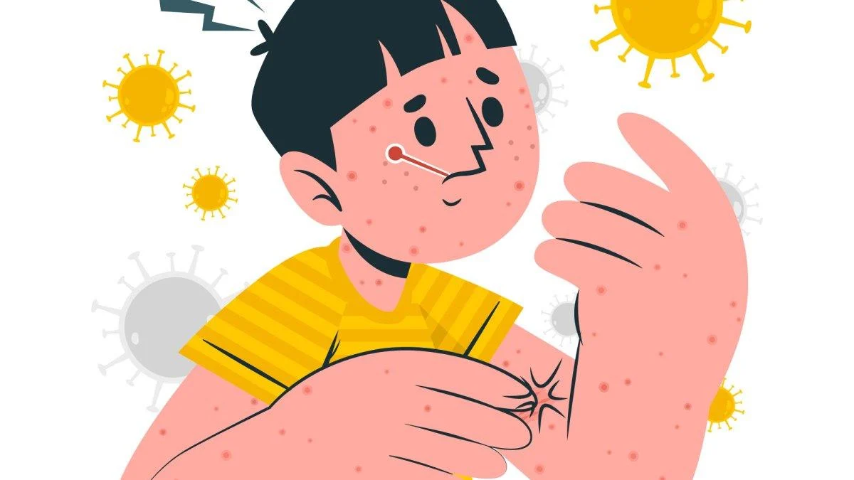 Vaksinasi Campak Dewasa: Solusi Penting Melindungi Kesehatan